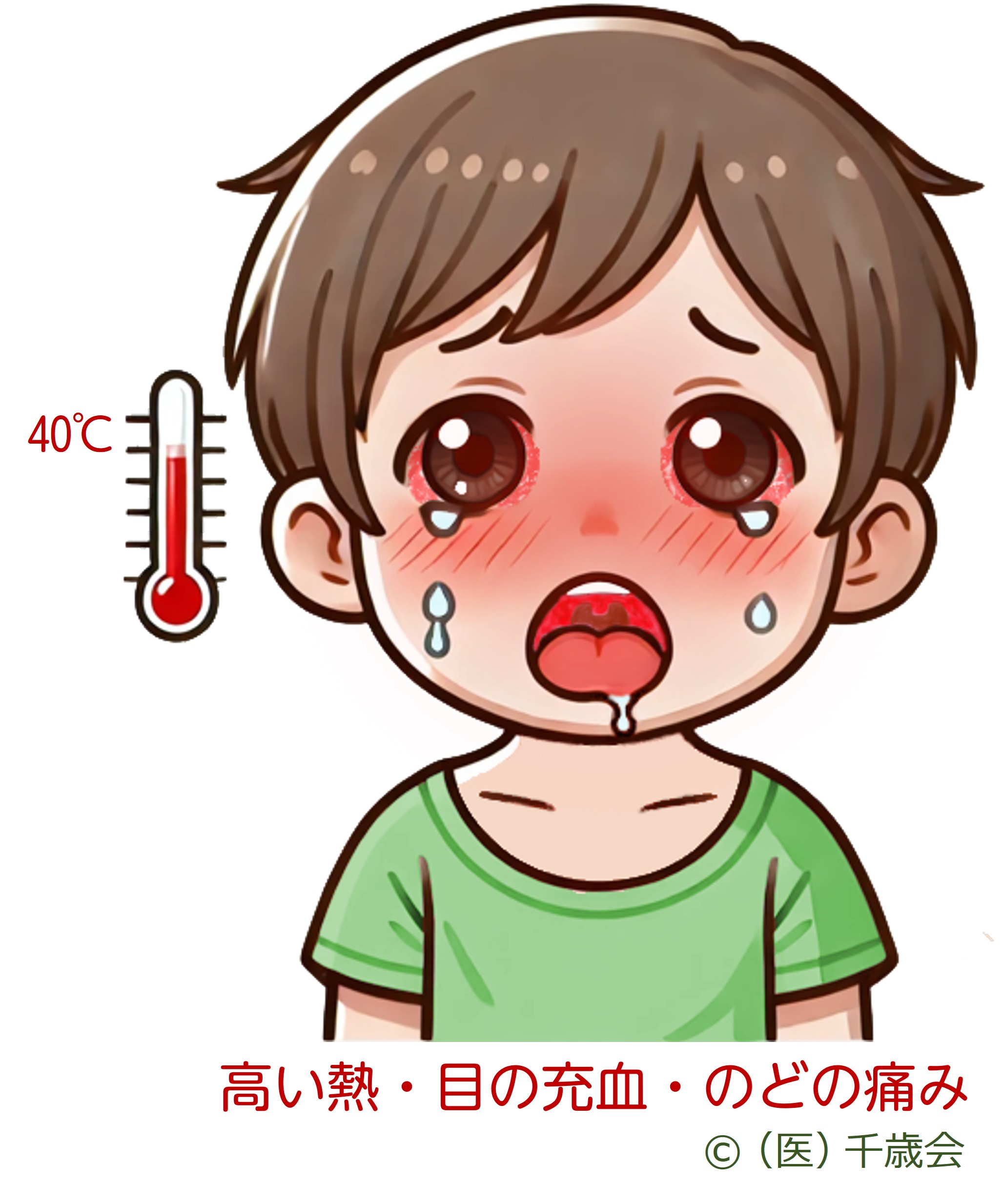咽頭結膜熱挿絵