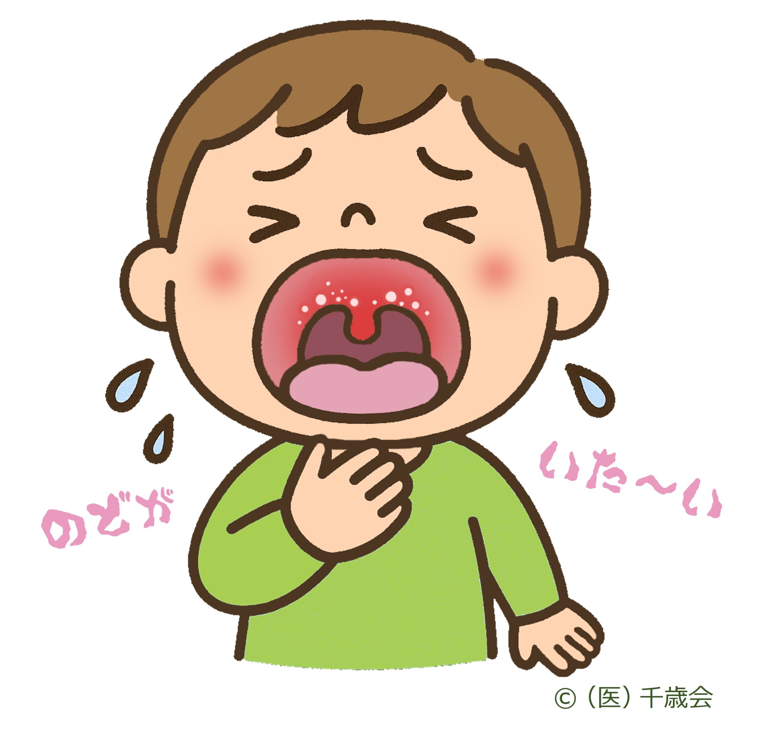 手足口病挿絵