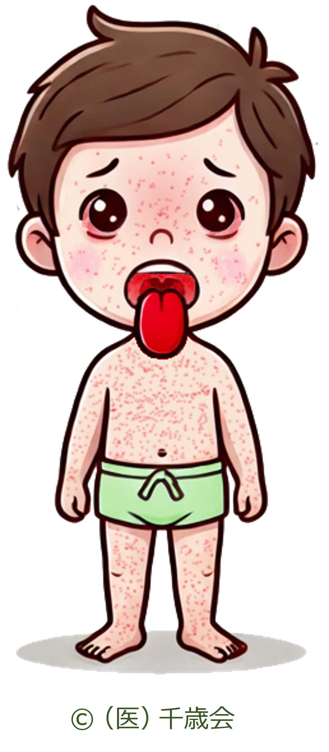 溶連菌性咽頭炎の幼児