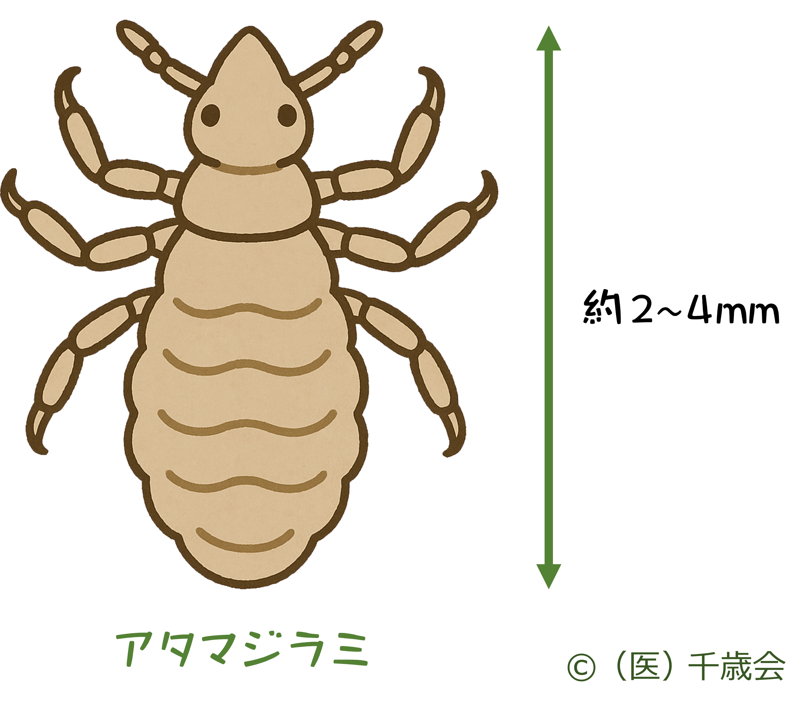 アタマジラミ